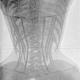 Illustration for article titled X-ray images of women in corsets show skeletons in a bind